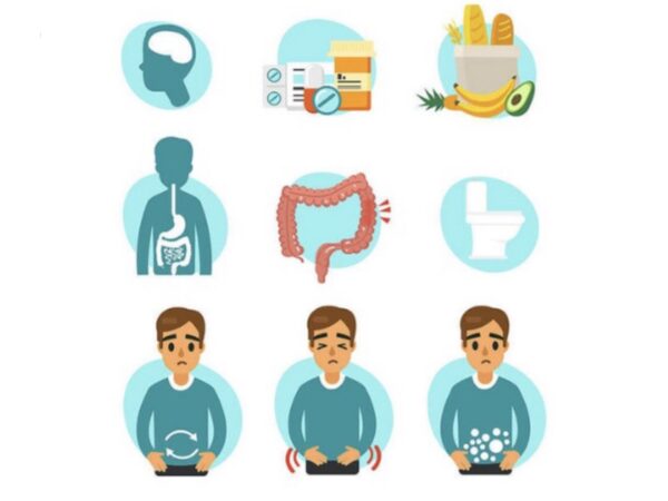 Sindrome del colon irritabile (IBS)